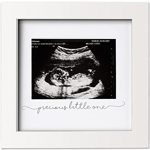 Baby Sonogram Picture Frame Modern Ultrasound Frame for Mom to Be Pregnancy Announcement Sonogram Photo Frames Gender Reveal for Expecting Parents First Time Dad Gifts Alpine White 0 belly baby and beyond
