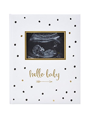Pearhead First 5 Years Baby Memory Book Gender Neutral Baby Keepsake for New and Expecting Parents Pregnancy And Milestone Journal 50 Fill In Pages Black and Gold Polka Dot 0 belly baby and beyond