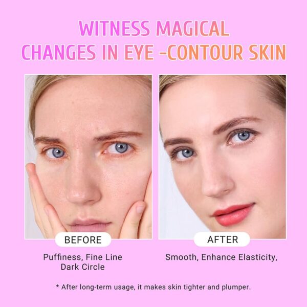 Under Eye Patches 30 Pairs Gold Eye Mask and Hyaluronic Acid Eye Patches for puffy eyesRose Eye Masks for Dark Circles and Puffiness under eye skin care Smooth Wrinkles products 0 2 belly baby and beyond